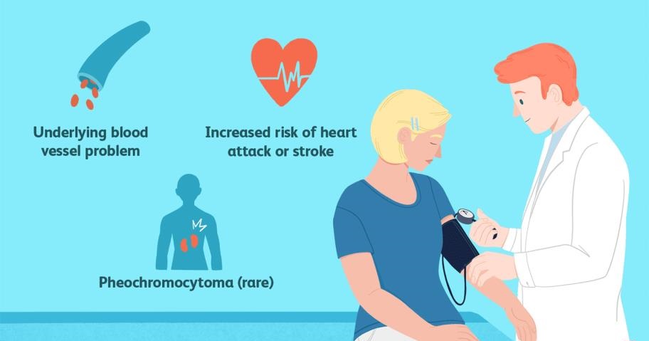 فشار خون بالا، درمان فشار خون